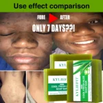 KYLIEFIT-Cool-Fresh-Aloe-Vera-Soap-Bar-for-All-Skin-Types-Reduce-Spots-Calm-Skin-Oil